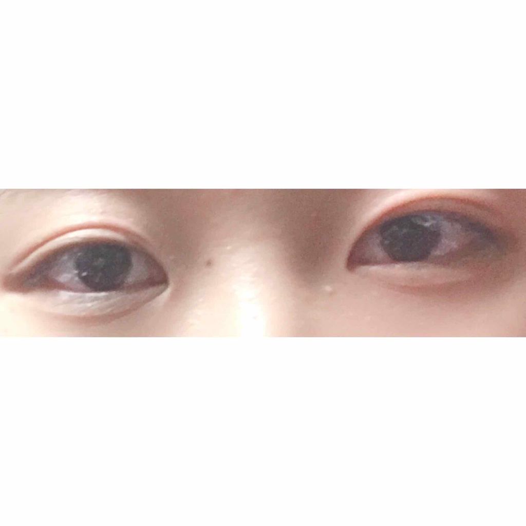 のびーるアイテープ（絆創膏タイプ、レギュラー）/DAISO/二重まぶた用アイテムを使ったクチコミ（3枚目）