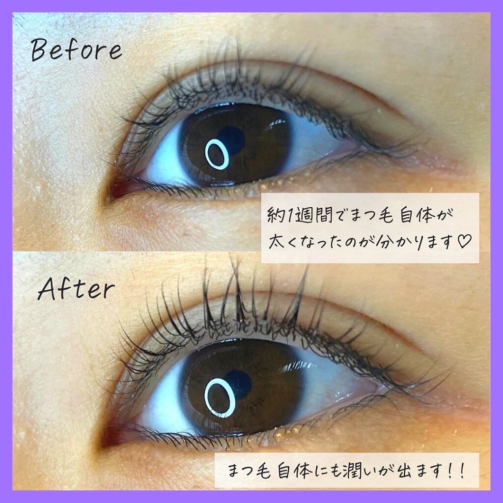 スカルプD ボーテ ピュアフリーアイラッシュセラム プレミアム/アンファー(スカルプD)/まつげ美容液を使ったクチコミ(7枚目)