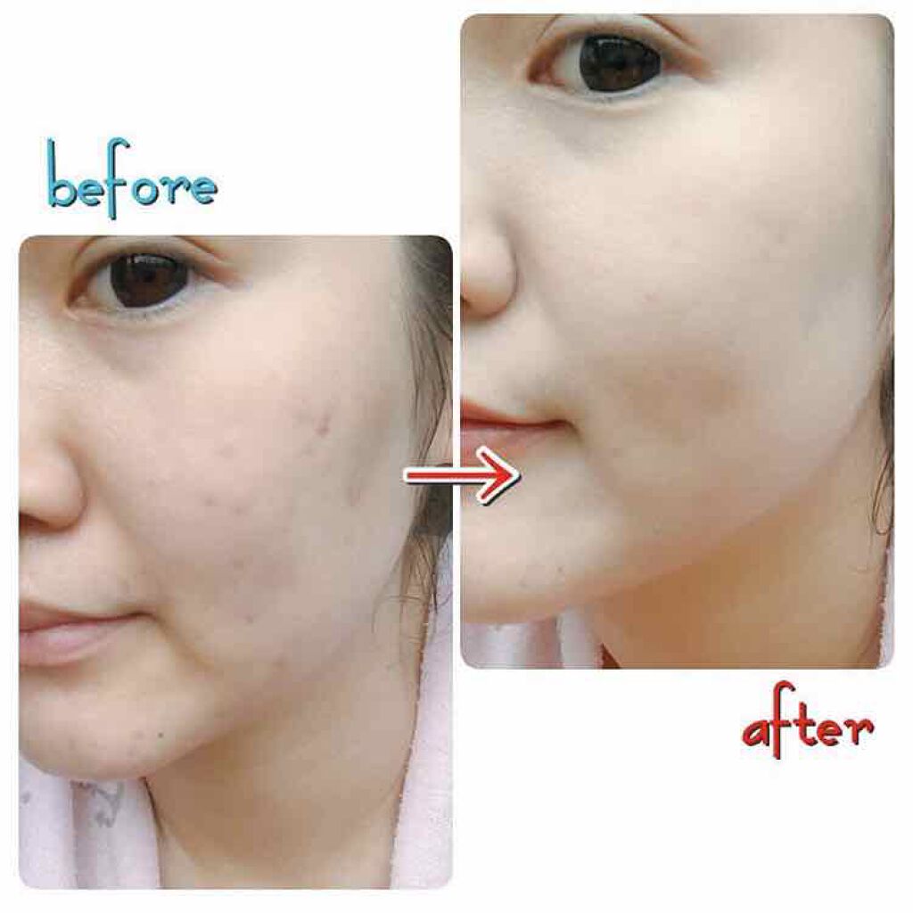 BBクッションファンデーション/Joy.coco(ジョイココ)/クッションファンデーションを使ったクチコミ(4枚目)