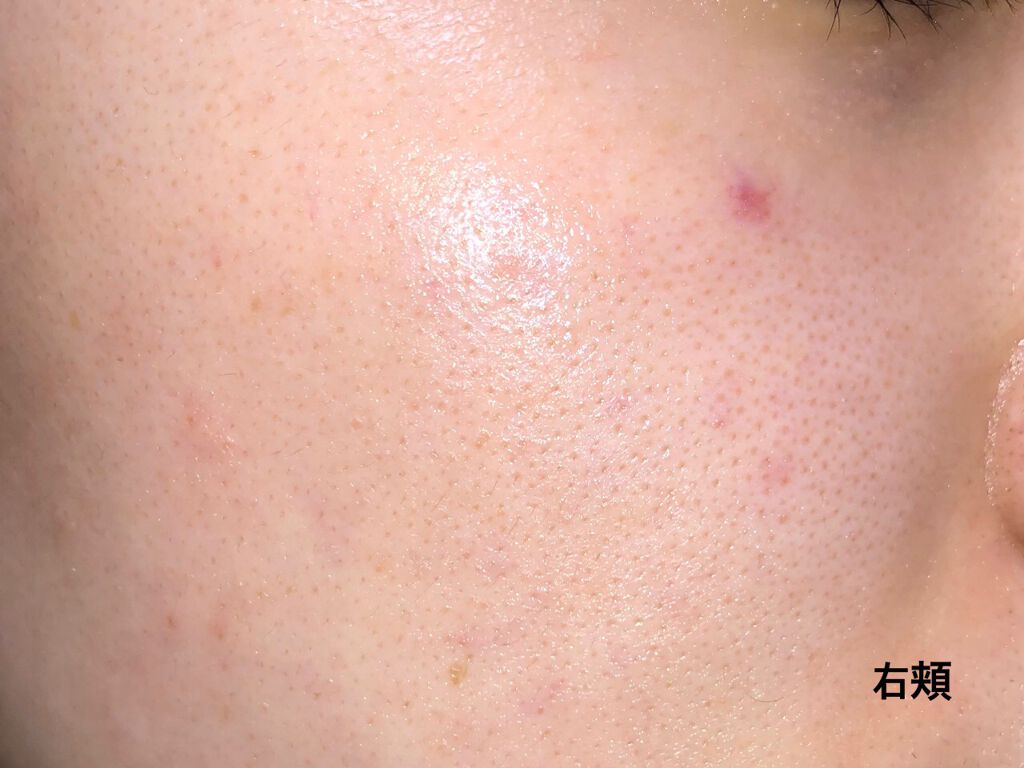 インビジブルピーリングブースターエッセンス/CNP Laboratory/ブースター・導入液を使ったクチコミ（2枚目）