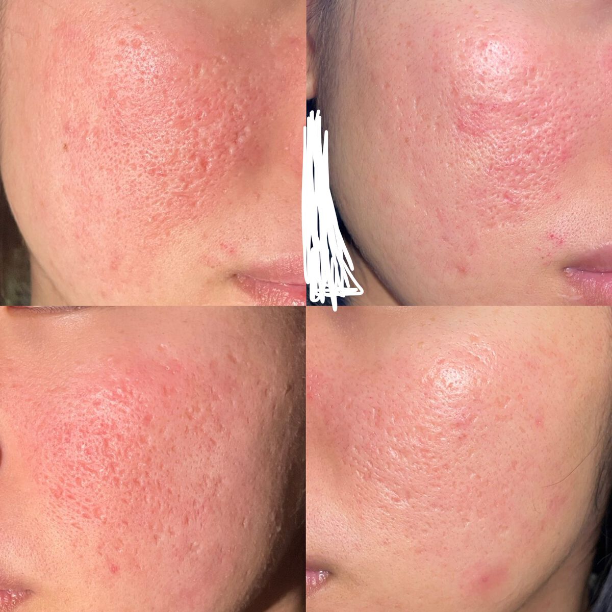 皮脂トラブルケア 化粧水/キュレル/化粧水を使ったクチコミ(2枚目)