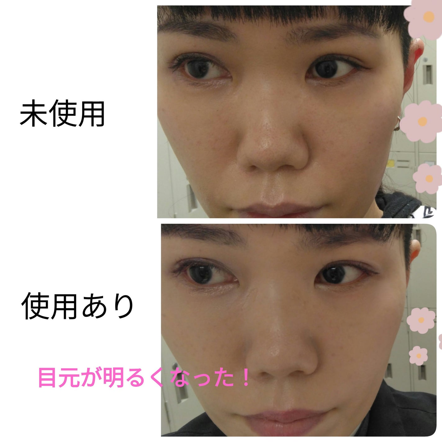 ピンポイントカラースナイパー/KATE/スティックコンシーラーを使ったクチコミ(3枚目)