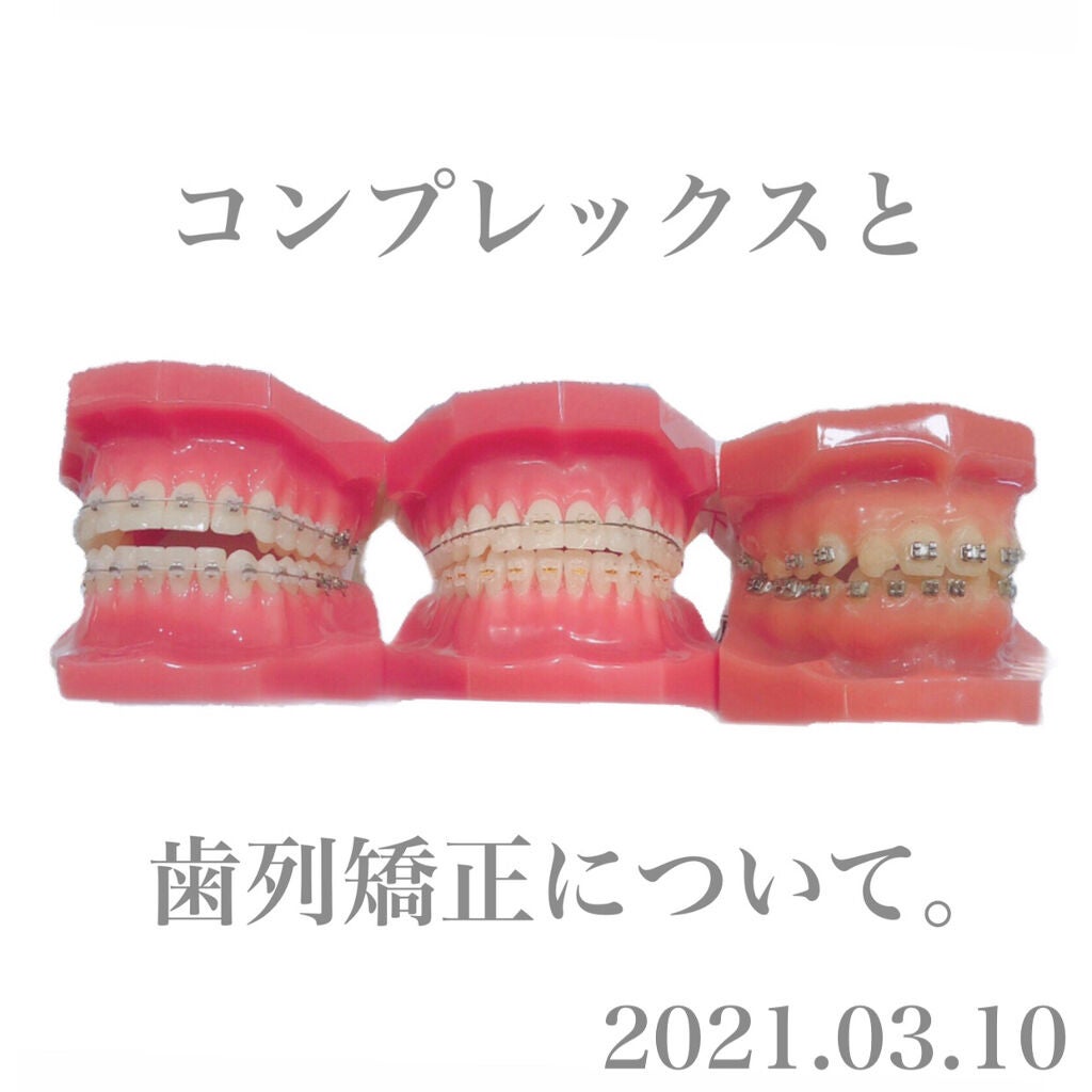 チャンユカ on LIPS 「歯列矯正についての経過を記録…φ(..)メモメモ⚠️口元ドアッ..」(1枚目)