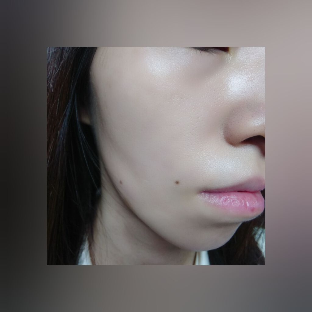 ミノン アミノモイスト 薬用マイルド ホワイトニング/ミノン/美容液を使ったクチコミ(4枚目)