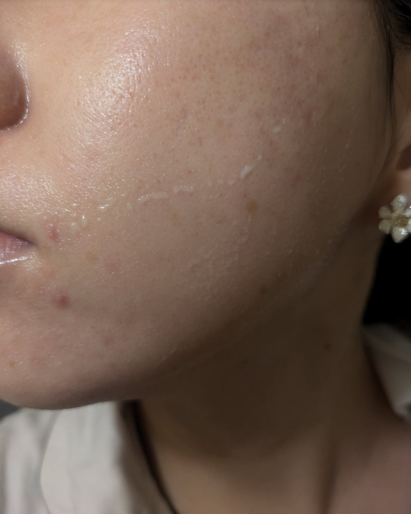 miina@汚肌工事録⚠️ on LIPS 「11/2の#汚肌工事録💐肌がのためにやっていること💊乳酸菌やビ..」(2枚目)