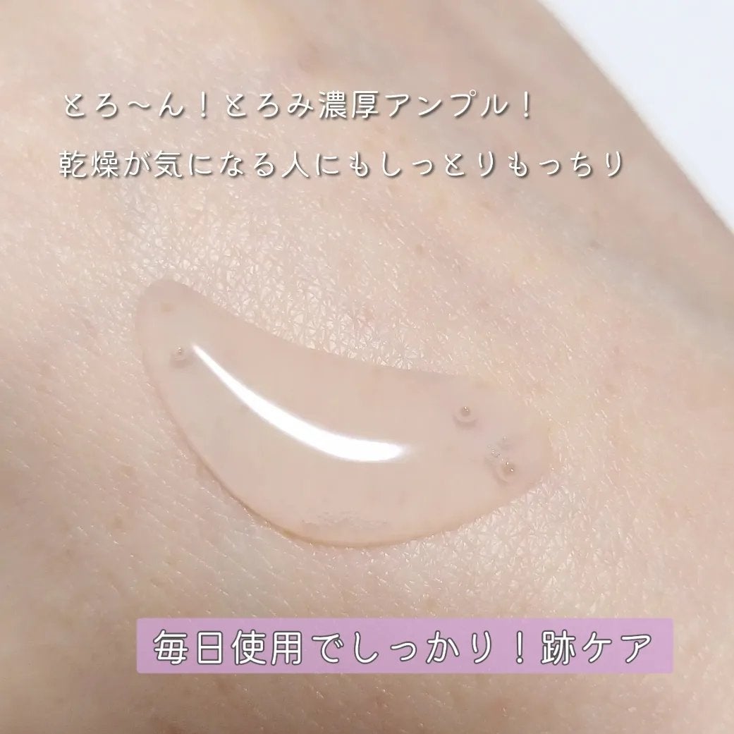 ナイアシンオニオン オールクリア アンプル/vividraw/美容液を使ったクチコミ(4枚目)