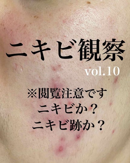 UHAグミサプリ ビタミンC/UHA味覚糖/食品を使ったクチコミ(1枚目)