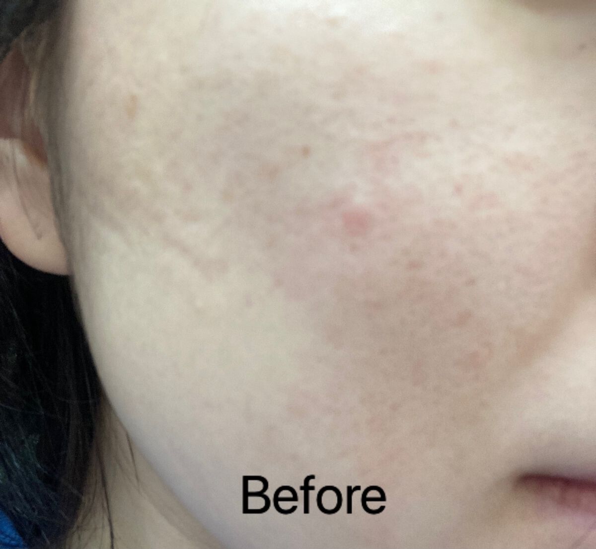 バイオ コンディショニング エッセンス/IOPE/ブースター・導入液を使ったクチコミ(5枚目)