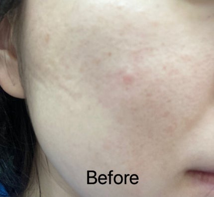 バイオ コンディショニング エッセンス/IOPE/ブースター・導入液を使ったクチコミ(5枚目)