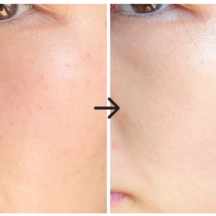 タンイドル ウルトラ ウェア リキッド/LANCOME/リキッドファンデーションを使ったクチコミ(3枚目)