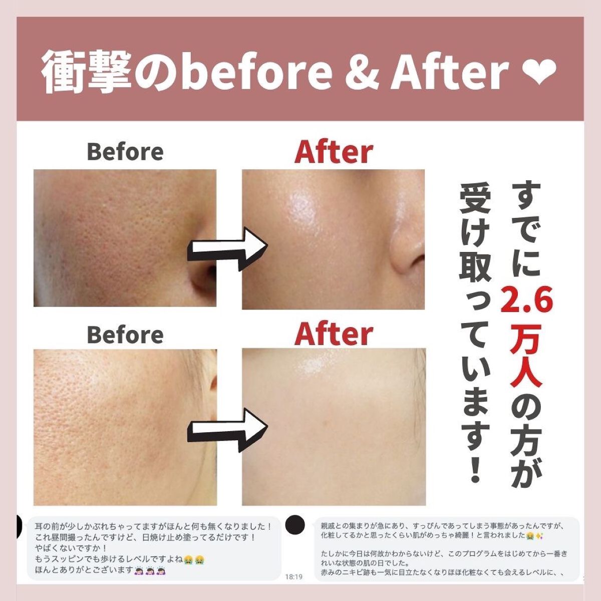 あなたの肌に合ったスキンケア💐コーくん先生 on LIPS 「【必ず見てください。】.
.
あなたの毛穴の開きが治らない
原..」(8枚目)