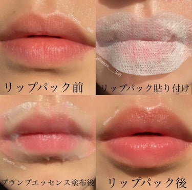 LIPS SHOT/MOTTO LAB./リップケア・リップクリームを使ったクチコミ（6枚目）