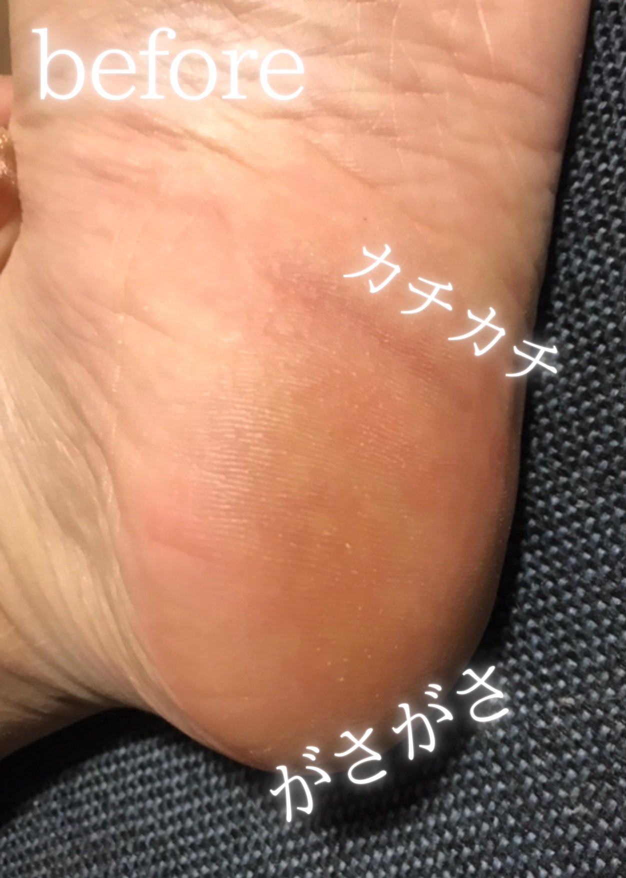 つるつる美素足/aogi/レッグ・フットケアを使ったクチコミ(2枚目)