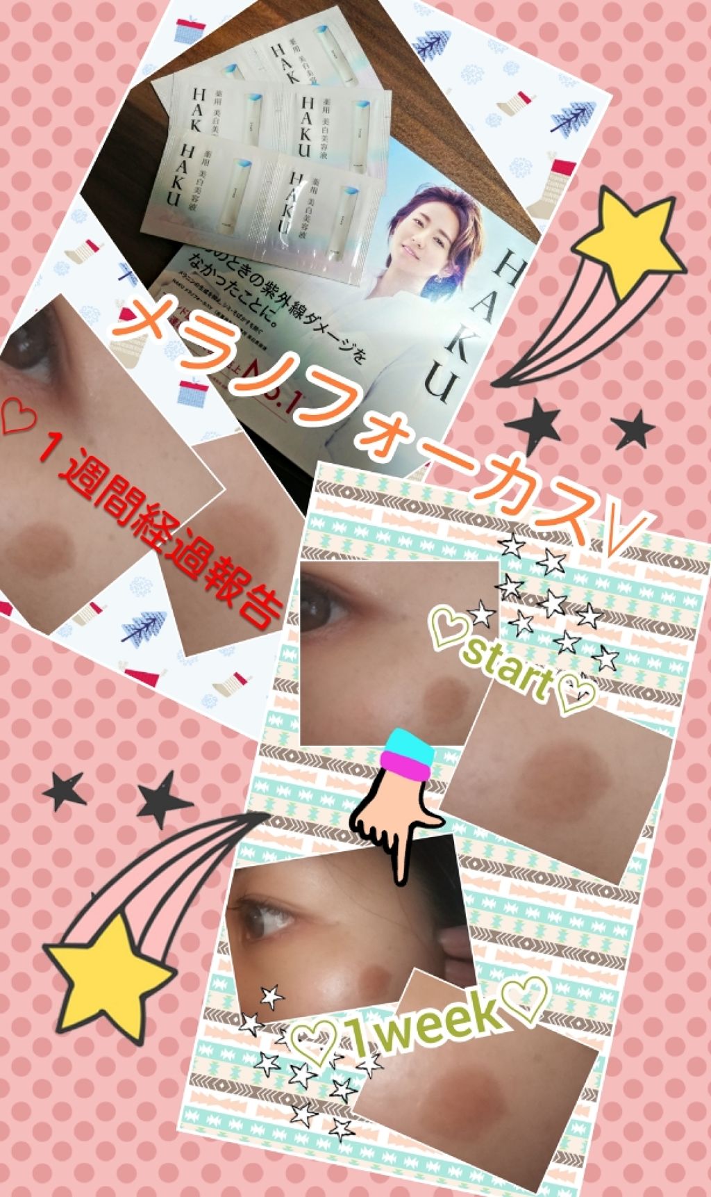 薬用美白 クリーム/DAISO/フェイスクリームを使ったクチコミ（2枚目）