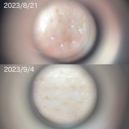 リードルショット300/VT/美容液を使ったクチコミ(3枚目)