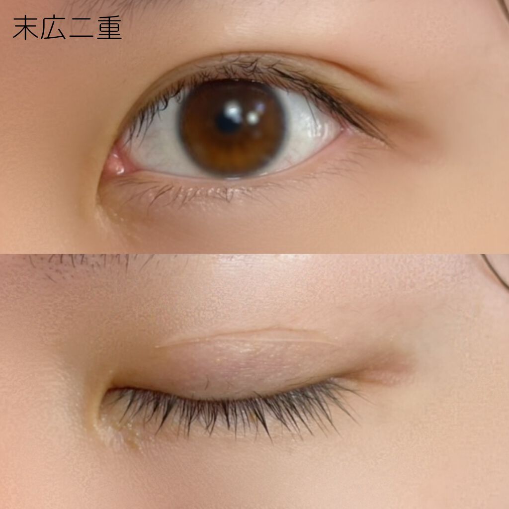 ワンダーアイリッドテープ Extra/D-UP/二重まぶた用アイテムを使ったクチコミ(6枚目)