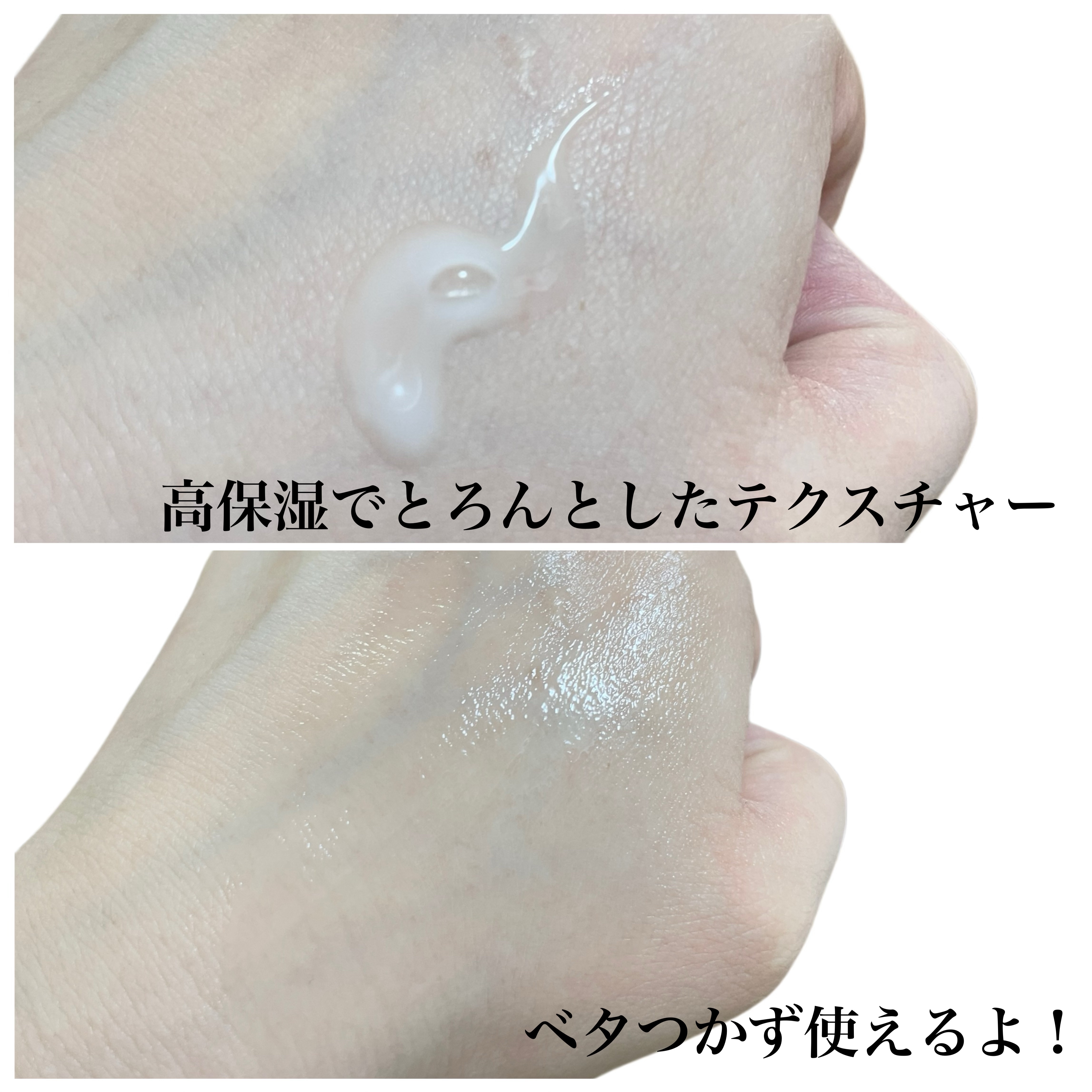 センテラ クイックカーミングパッド/SKIN1004/トナーパッドを使ったクチコミ（3枚目）