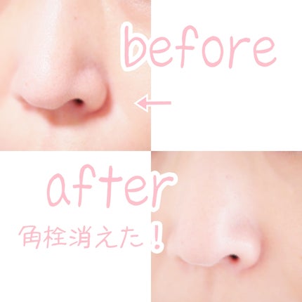 ホットブラックジェルクレンジング/.akaran/クレンジングジェルを使ったクチコミ(5枚目)