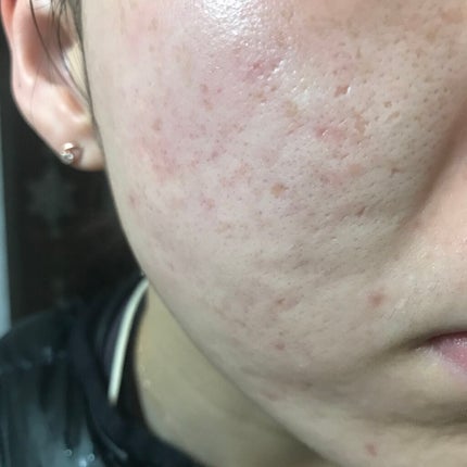 ドクタージャルト シカペア リカバー (第2世代)/Dr.Jart+/フェイスクリームを使ったクチコミ(3枚目)