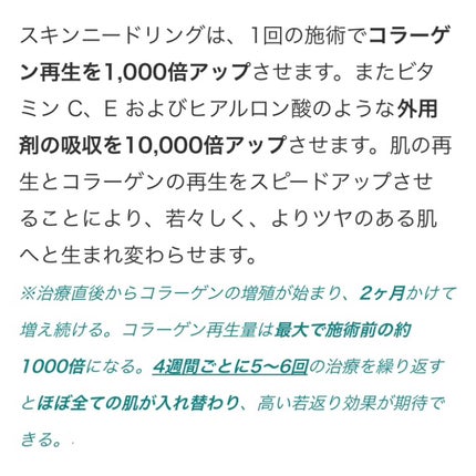 Regen Skin SRS Mask Pack medi/RegenSkin/シートマスク・パックを使ったクチコミ(4枚目)