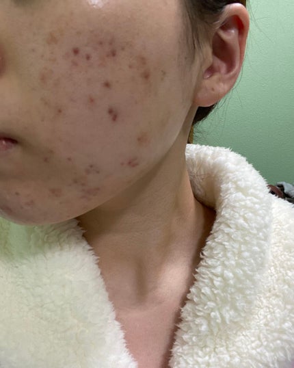 化粧水・敏感肌用・高保湿タイプ/無印良品/化粧水を使ったクチコミ(4枚目)