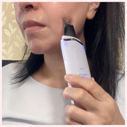 モイスチャーピーリングプロ/Le ment/美顔器・マッサージを使ったクチコミ(3枚目)