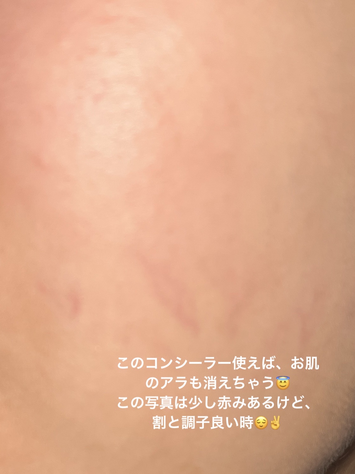 ダーマシンコンシーラー/23years old/リキッドコンシーラーを使ったクチコミ（1枚目）