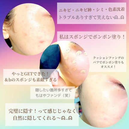 【旧】ディオールスキン フォーエヴァー スキン コレクト コンシーラー/Dior/リキッドコンシーラーを使ったクチコミ(3枚目)