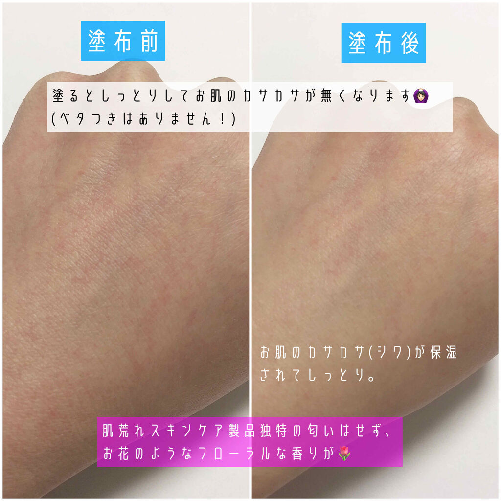 ピンクティーツリートナー/APLIN/化粧水を使ったクチコミ（3枚目）