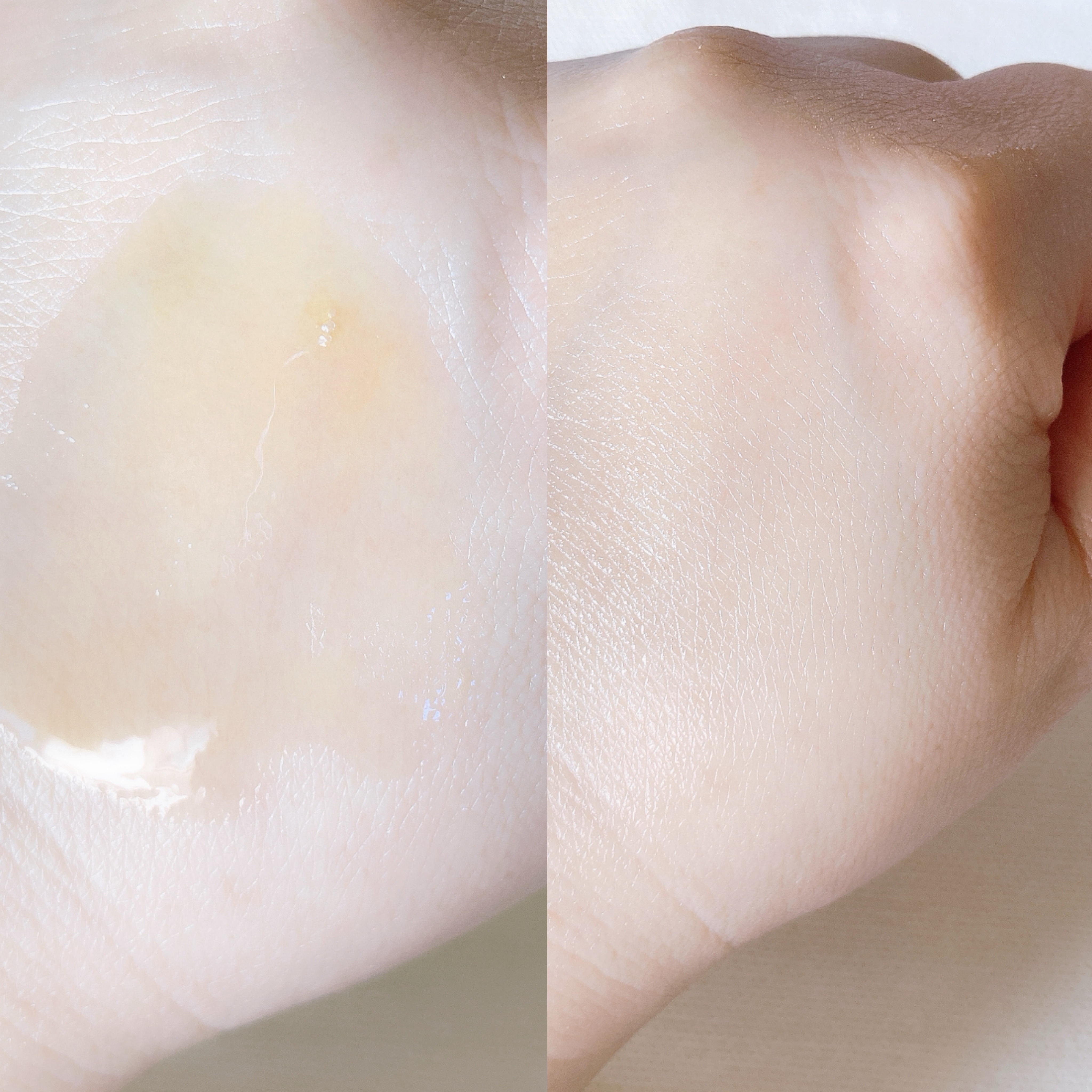 ガラクトミセスピュアビタミンCグローセラム/SOME BY MI/美容液を使ったクチコミ（2枚目）