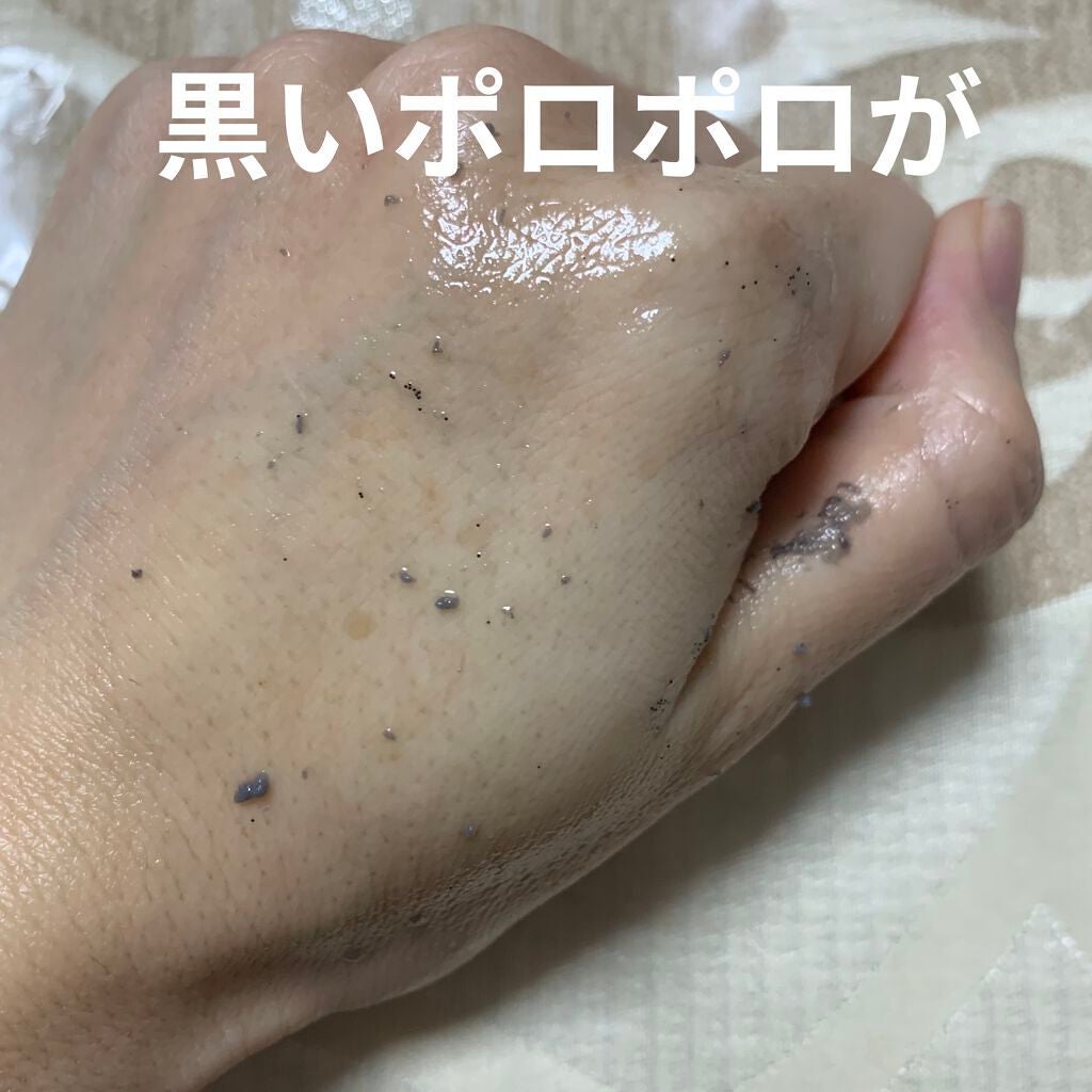 DETクリア ブライト&ピール ピーリングジェリー<ミックスフルーツの香り>/Detclear/ピーリングを使ったクチコミ(5枚目)