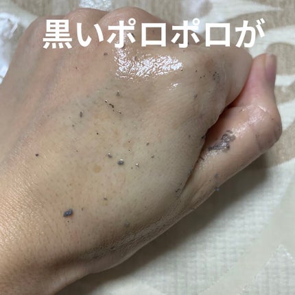 DETクリア ブライト&ピール ピーリングジェリー<ミックスフルーツの香り>/Detclear/ピーリングを使ったクチコミ(5枚目)