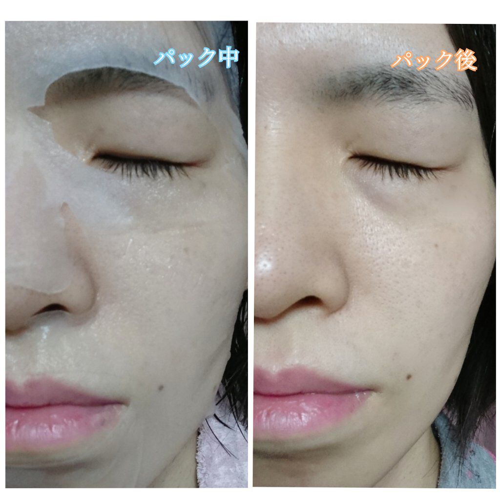 ティーツリー ケアソリューション AP 2ステップマスク JEX/MEDIHEAL/シートマスク・パックを使ったクチコミ(6枚目)