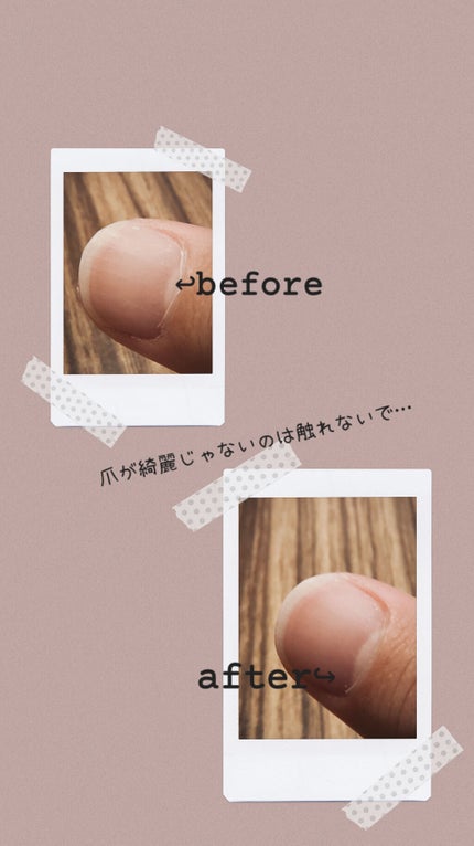 甘皮ケアオイル/無印良品/ネイルオイル・トリートメントを使ったクチコミ(3枚目)