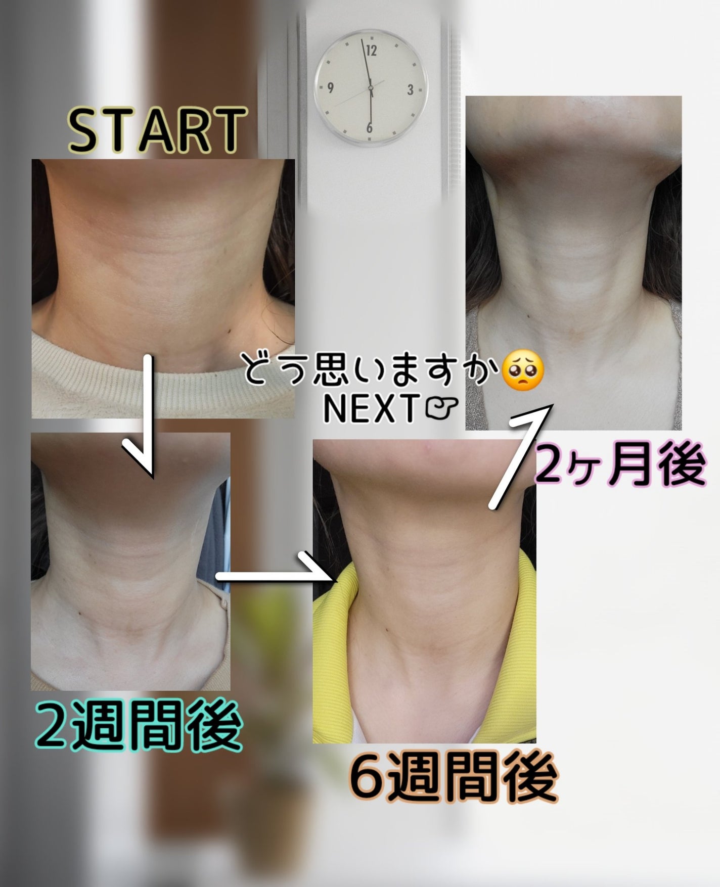 ザ マイトル エッセンス/THE MYTOL/ブースター・導入液を使ったクチコミ(3枚目)