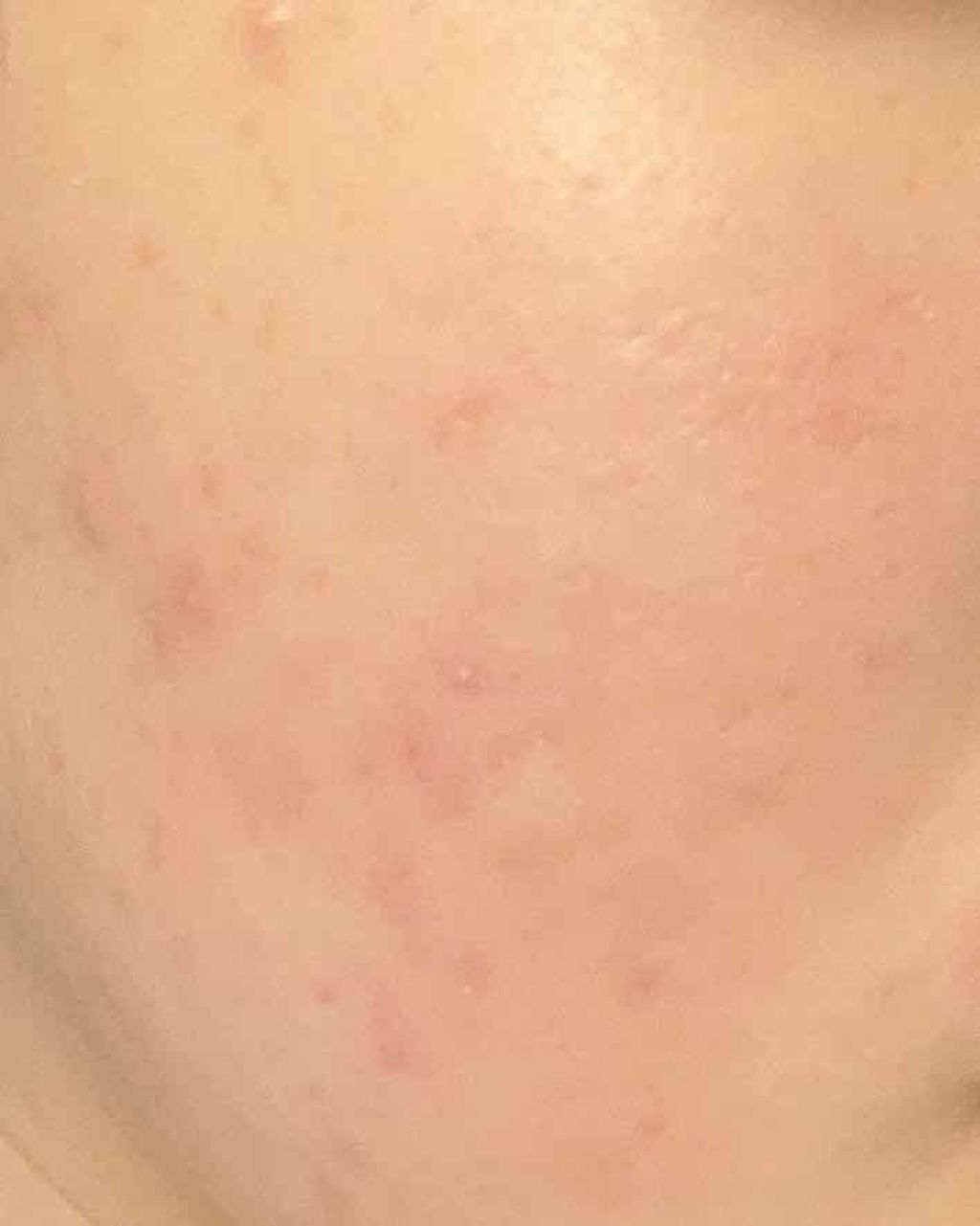 デュオ ザ クレンジングバーム/DUO/クレンジングバームを使ったクチコミ（3枚目）