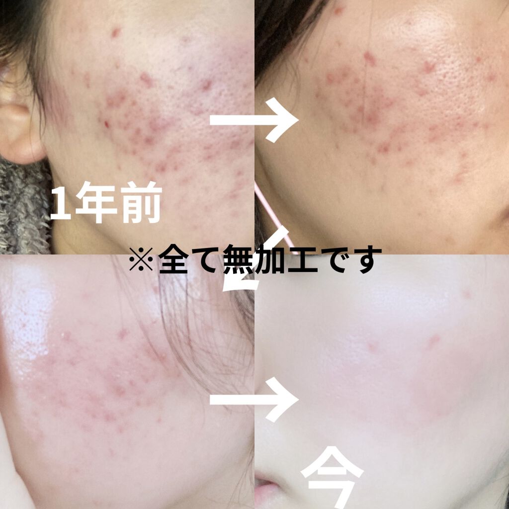 DHC ビタミンＣハードカプセル/DHC/美容サプリメントを使ったクチコミ（2枚目）