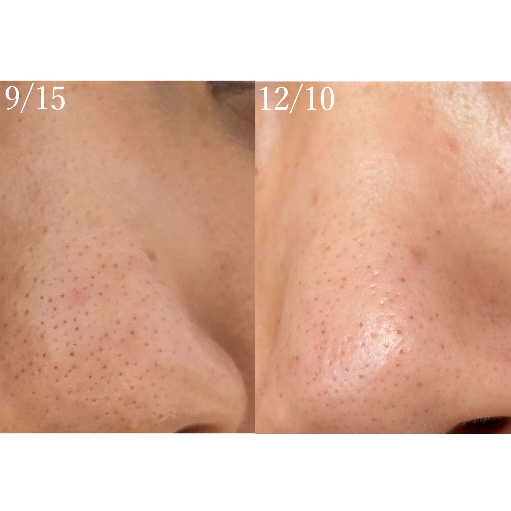 試してみた】ビタピュアクト HIDEMARI MEDICAL（ひでまりメディカル