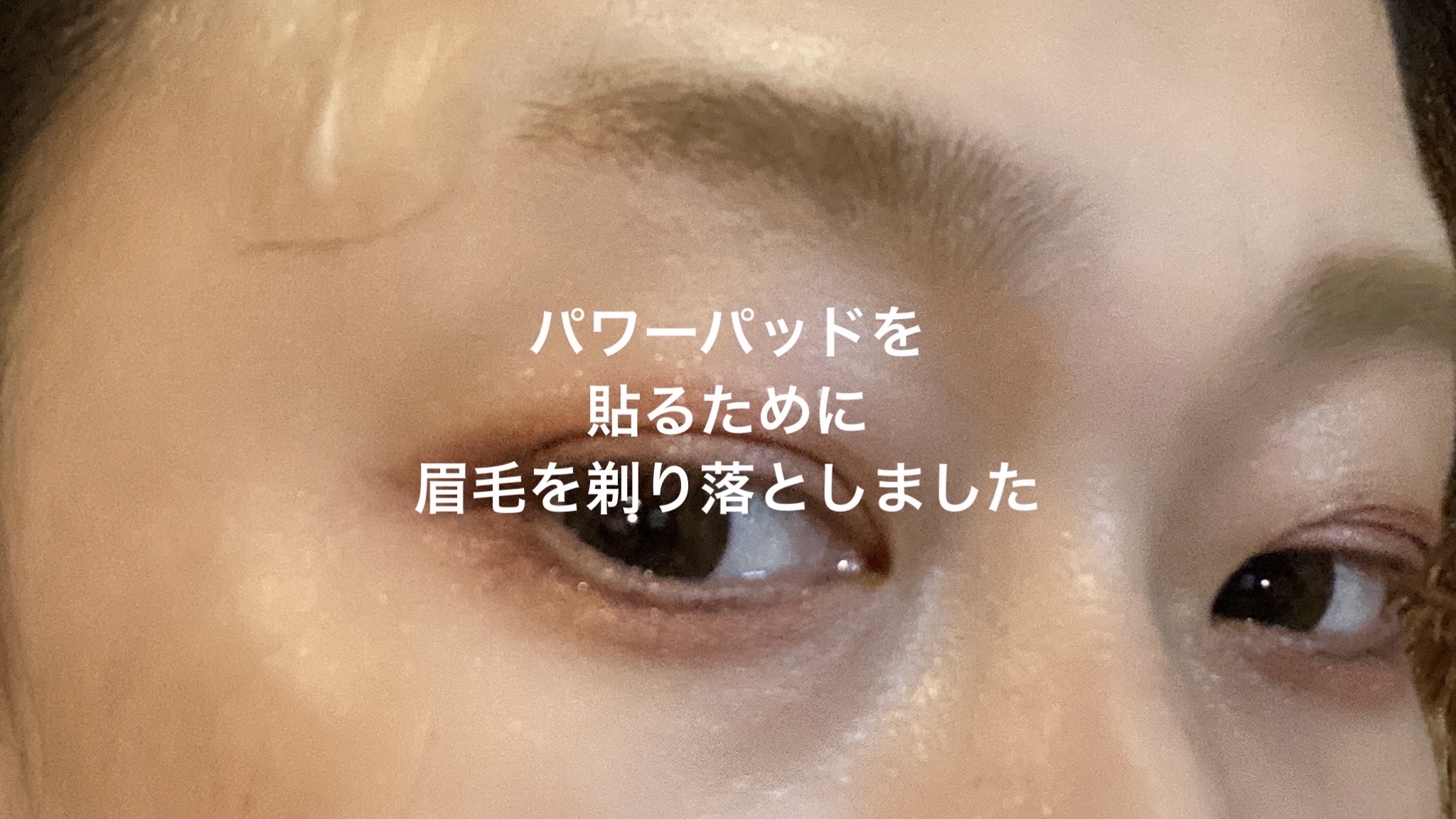 キズパワーパッド/バンドエイド/その他を使ったクチコミ（3枚目）