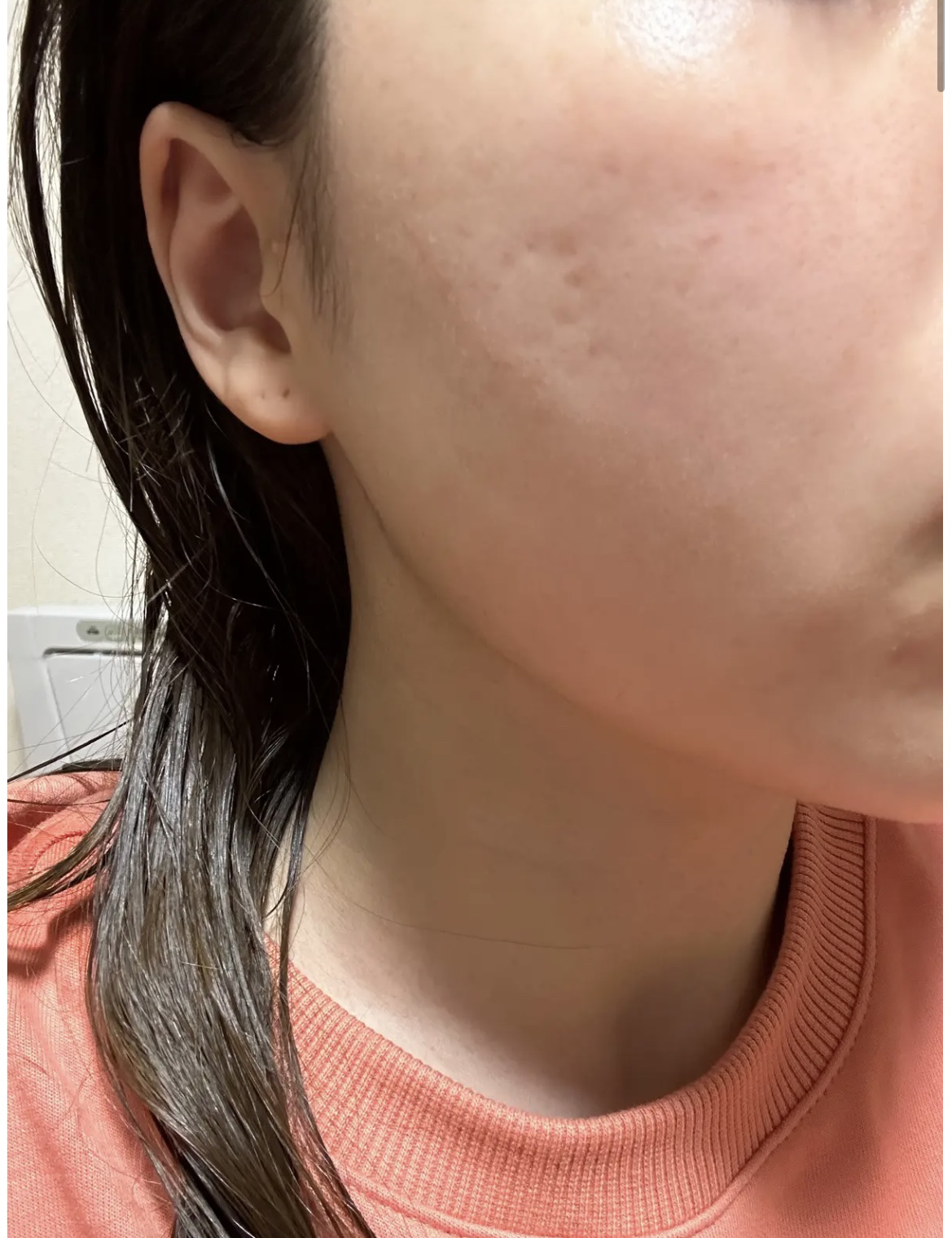 W.H.P ブラックマスク JEX/MEDIHEAL/シートマスク・パックを使ったクチコミ（1枚目）