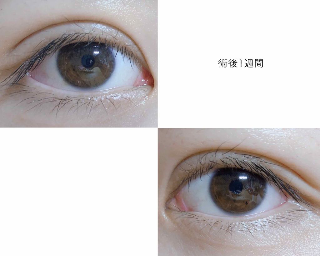 ラッシュジェリードロップ/MAJOLICA MAJORCA/まつげ美容液を使ったクチコミ（3枚目）