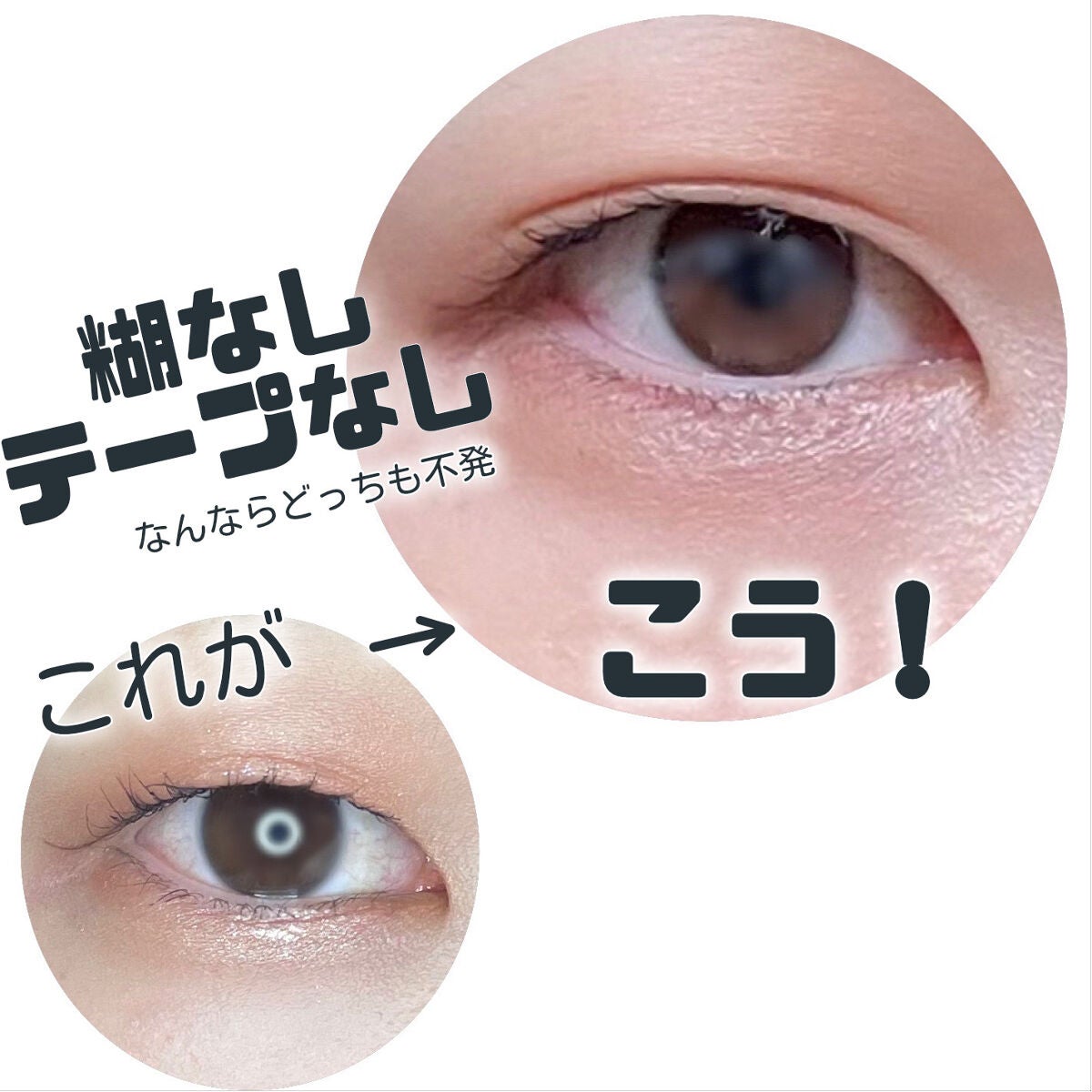 ひとえ・奥ぶたえ用カーラー/アイプチ®/ビューラーを使ったクチコミ(1枚目)