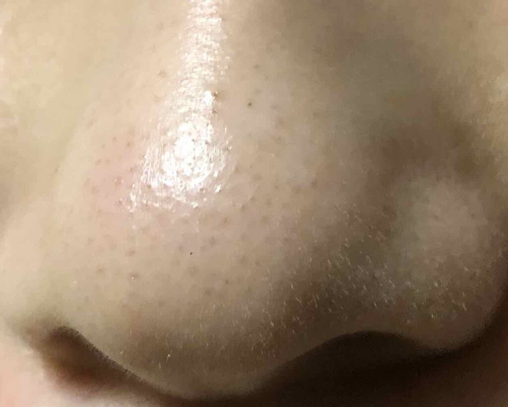 マイルドピーリングパッド/PUFFY POD/トナーパッドを使ったクチコミ（3枚目）