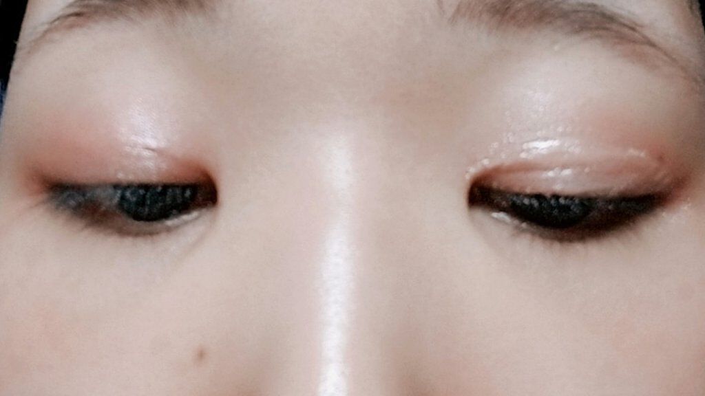 オリシキ アイリッドスキンフィルム /D-UP/二重まぶた用アイテムを使ったクチコミ(4枚目)