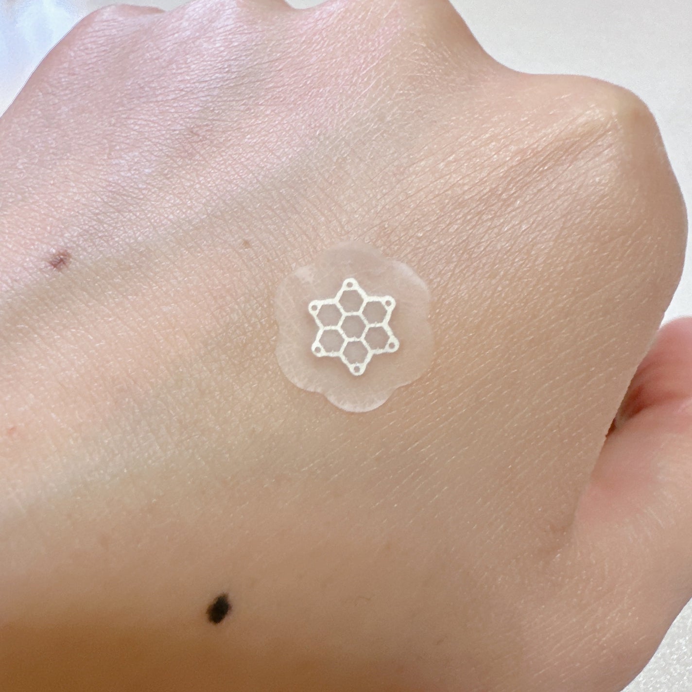 ACマグネシウムパッチ ミニ/スノーツープラス/にきびパッチを使ったクチコミ(3枚目)