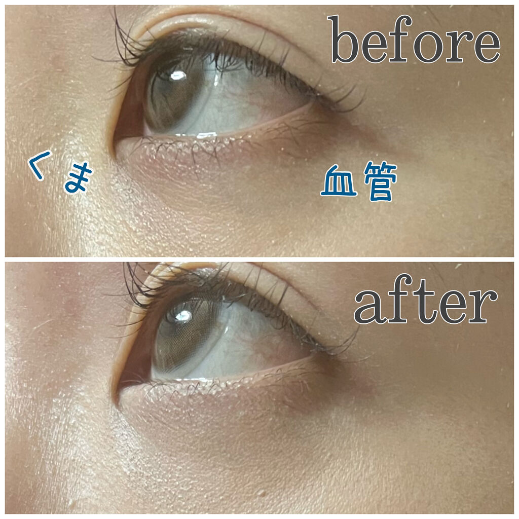 マジックコンシーラー/カリプソ/リキッドコンシーラーを使ったクチコミ（2枚目）