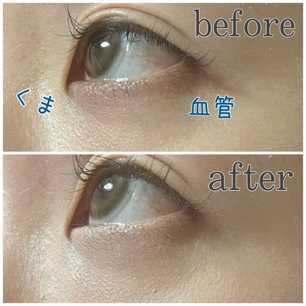 マジックコンシーラー/カリプソ/リキッドコンシーラーを使ったクチコミ(2枚目)