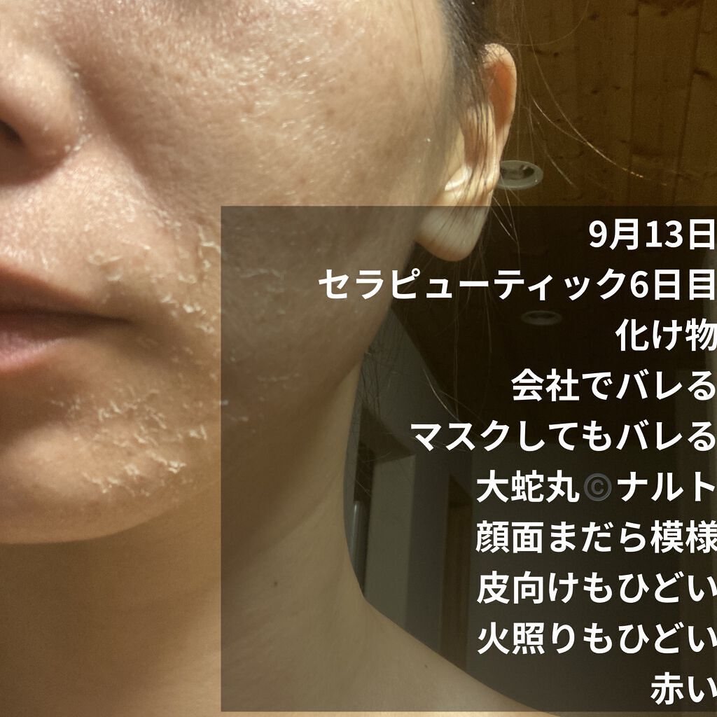 ミラミックス/ZO Skin Health/フェイスクリームを使ったクチコミ（2枚目）