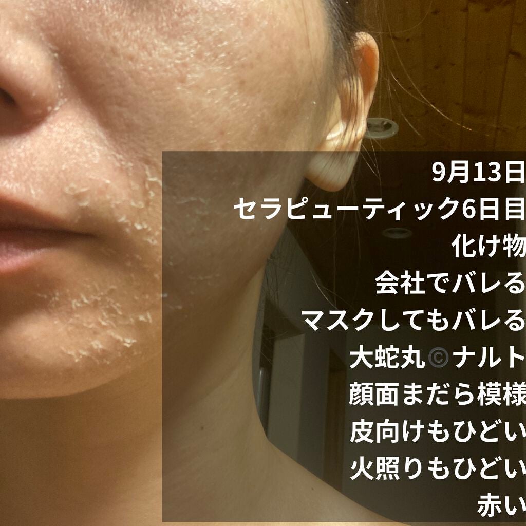 ミラミックス/ZO Skin Health/フェイスクリームを使ったクチコミ(2枚目)