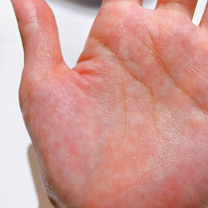 ピンクアロエビタトナー/APRILSKIN/化粧水を使ったクチコミ(3枚目)